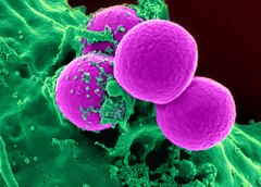 Image of neutrophil