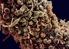 Micrograph of an infected cell