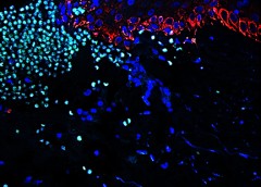 Image of skin would trying to heal