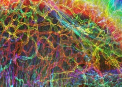 image showing the interface of skin and muscle during mammalian development