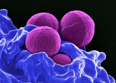 Image of MRSA bacteria being engulfed by neutrophils