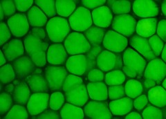 This image shows a confocal scan of mouse ear lipocartilage stained with a green fluorescent lipid dye called BODIPY. Large lipid vacuoles are bright green.