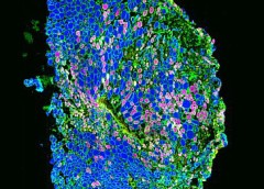 Immunofluorescence image of muscle fibers