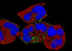 Picture of neutrophils