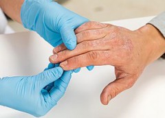 doctor wearing gloves examines hand of a patient