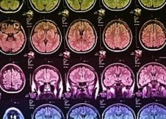 Photo showing multiple x-rays of the human brain