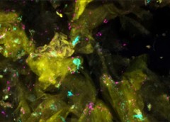 Healthy human skin cells (yellow) are home to bacteria (bright pink), fungi (light blue), and other microorganisms.