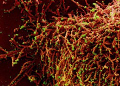 micrograph of a cell (red) infected with a variant strain of SARS-CoV-2 virus particles (green)
