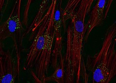 Fibroblasts (red lines with blue nuclei)