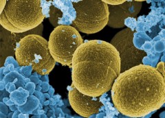 Scanning electron micrograph of S. aureus bacteria escaping destruction by human white blood cells.