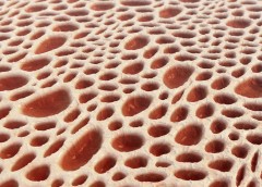 a photograph showing the tissue structure of bone